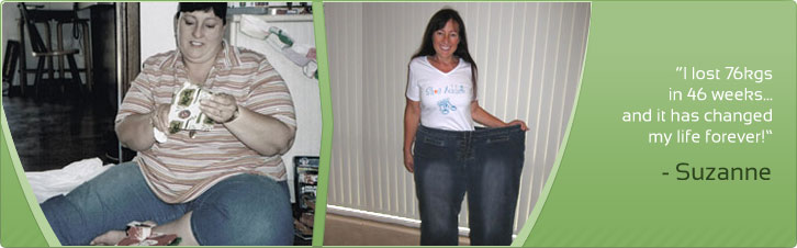 Suzanne lost 76kg