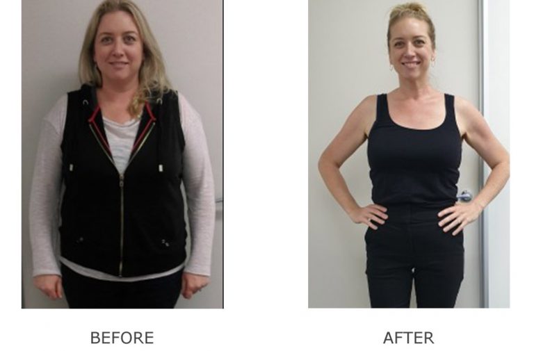Before And After Weight Loss Clinic